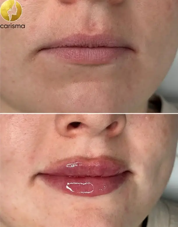 carisma